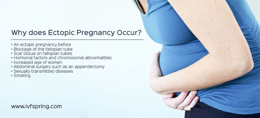 Why does Ectopic Pregnancy Occur