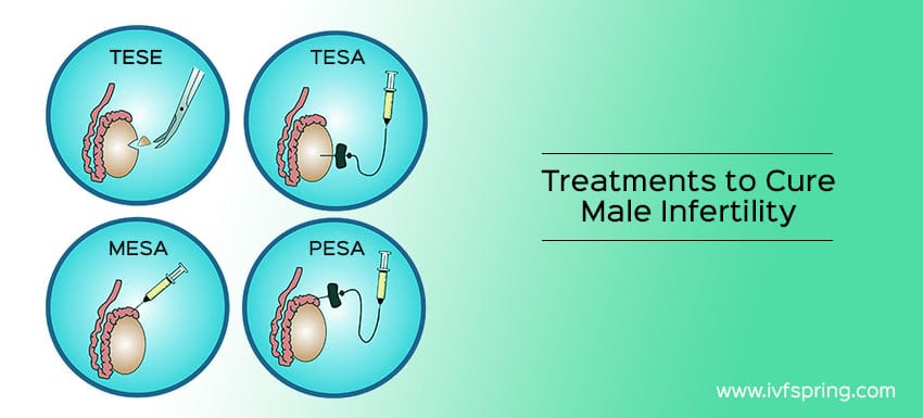 Treatment options to Cure Male Infertility!