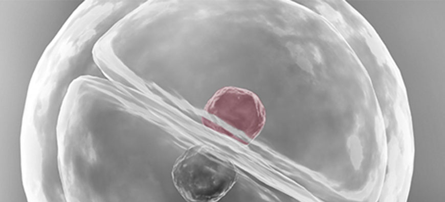 IVF-Spring-EmbryoScope