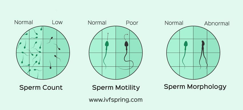 Know about Male Fertility Tests